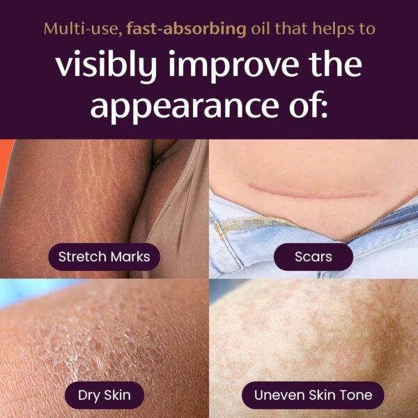 Quick Dry Oil, Scar and Stretch Mark Treatment, Helps to Improve the Appearance of Scars and Stretch Marks, with Natural Botanical Extracts, Paraben Free, Fast-Absorbing, 2.02Oz (60Ml) - Image 4